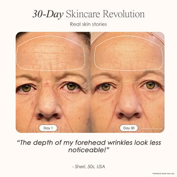 Nuvio 9-Spectrum Anti-Aging Therapy Mask